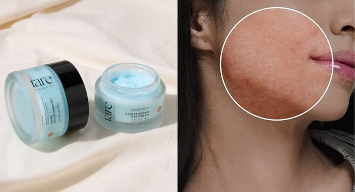 Unveiling the Reality of Sensitive Skin: Why Less is More for Your Barrier?