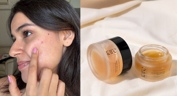 What Does Niacinamide Do for Oily Indian Skin? Rare Chemistry’s Tips for Perfect Skin