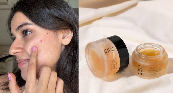 What Does Niacinamide Do for Oily Indian Skin? Rare Chemistry’s Tips for Perfect Skin
