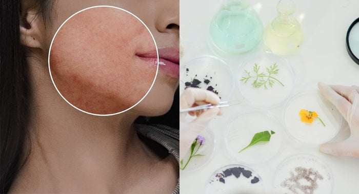 Why You Shouldn’t Be Proud of Having Sensitive Skin