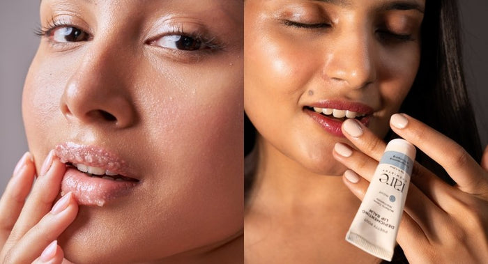 Depigmenting Lip Balm: Here is the Secret to Restoring Your Natural Lip Color