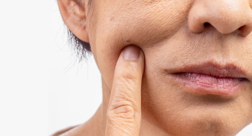 Dry vs. Dehydrated Skin: Understanding the Difference for the Perfect Skincare Ritual