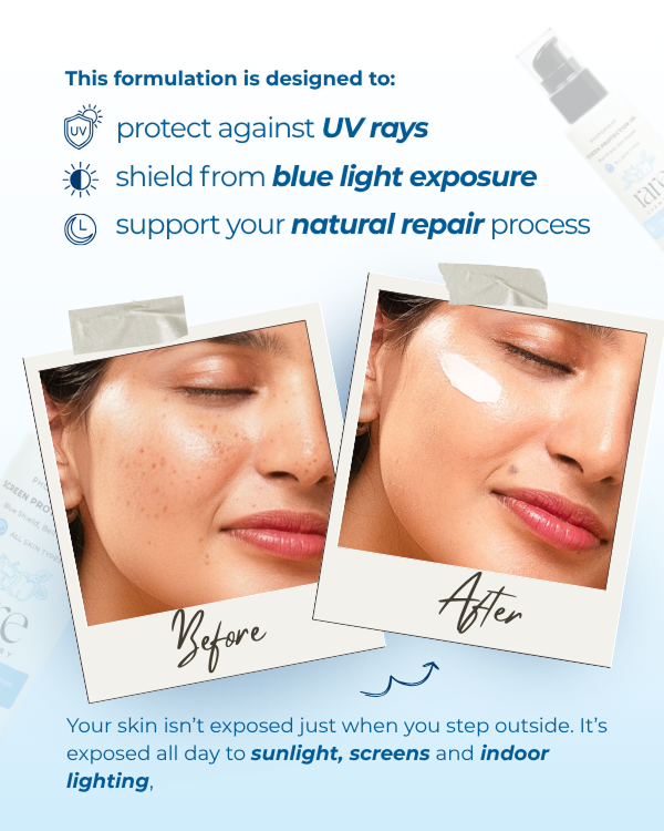Screen Protection Gel