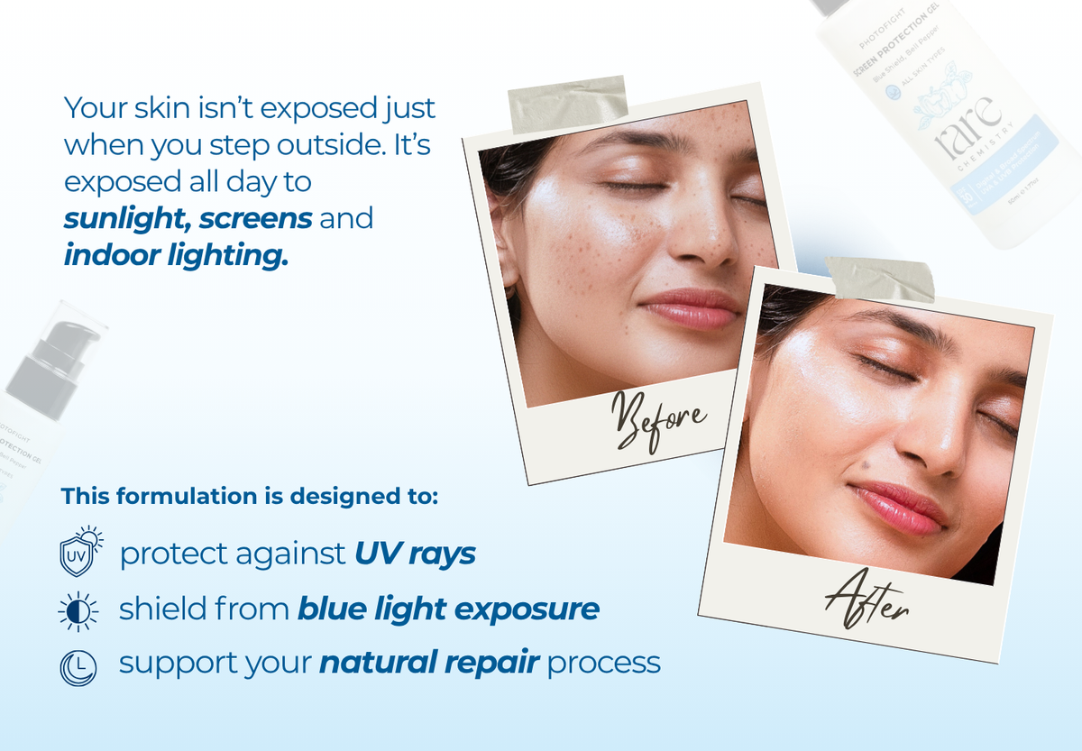Screen Protection Gel