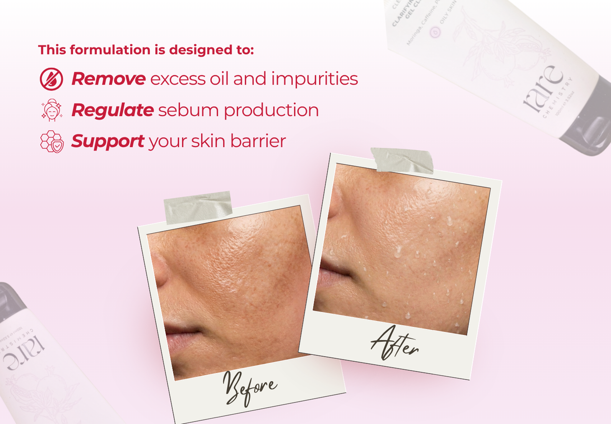 Clarifying Soap Free Gel Cleanser