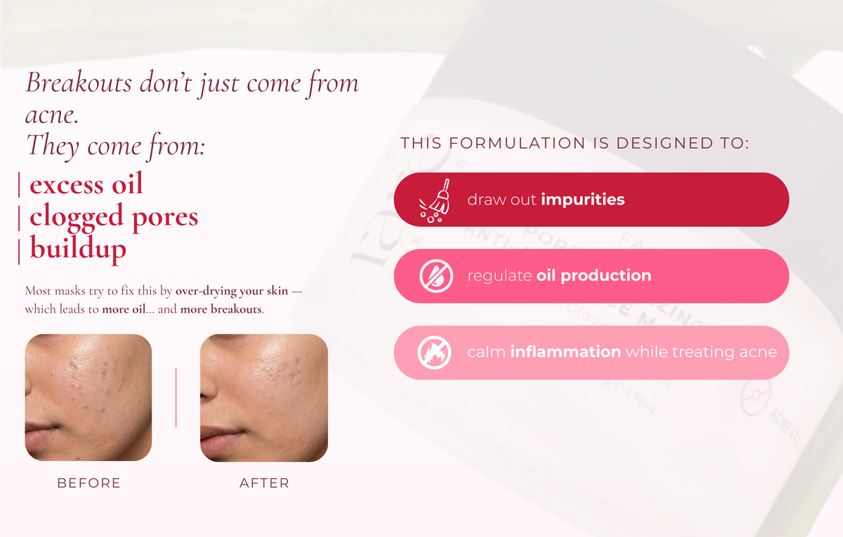 Pore Minimizing Anti Acne Face Mask