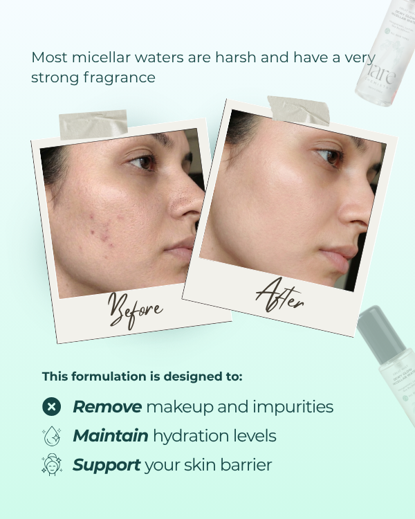 Dewy Glow Micellar Water