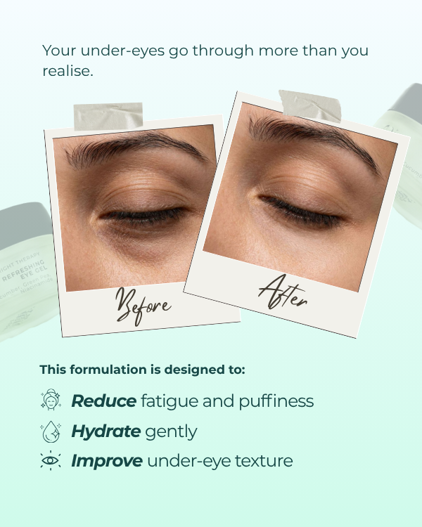 Refreshing Eye Gel