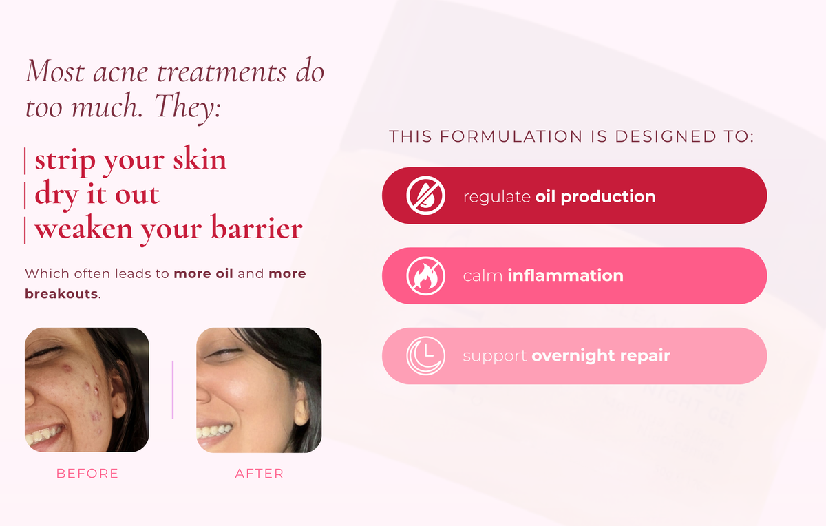 Blemish Rescue Night Gel