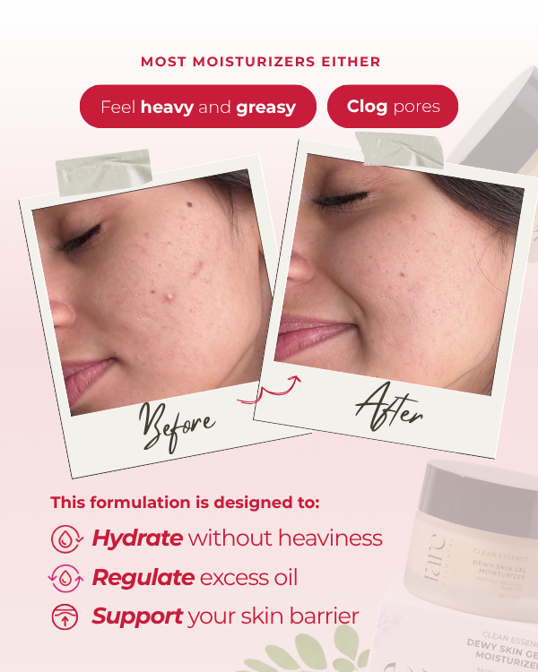 Dewy Skin Gel Moisturizer