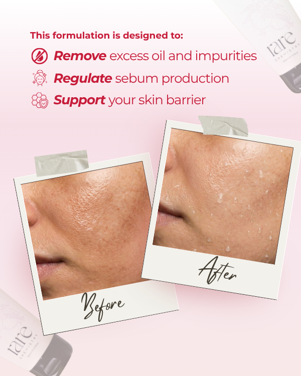 Clarifying Soap Free Gel Cleanser