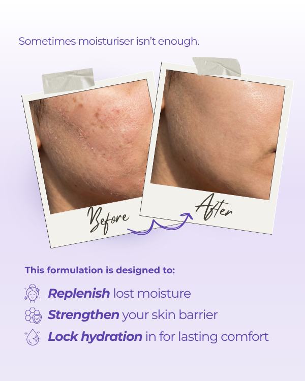 Moisture Lock Face Mask