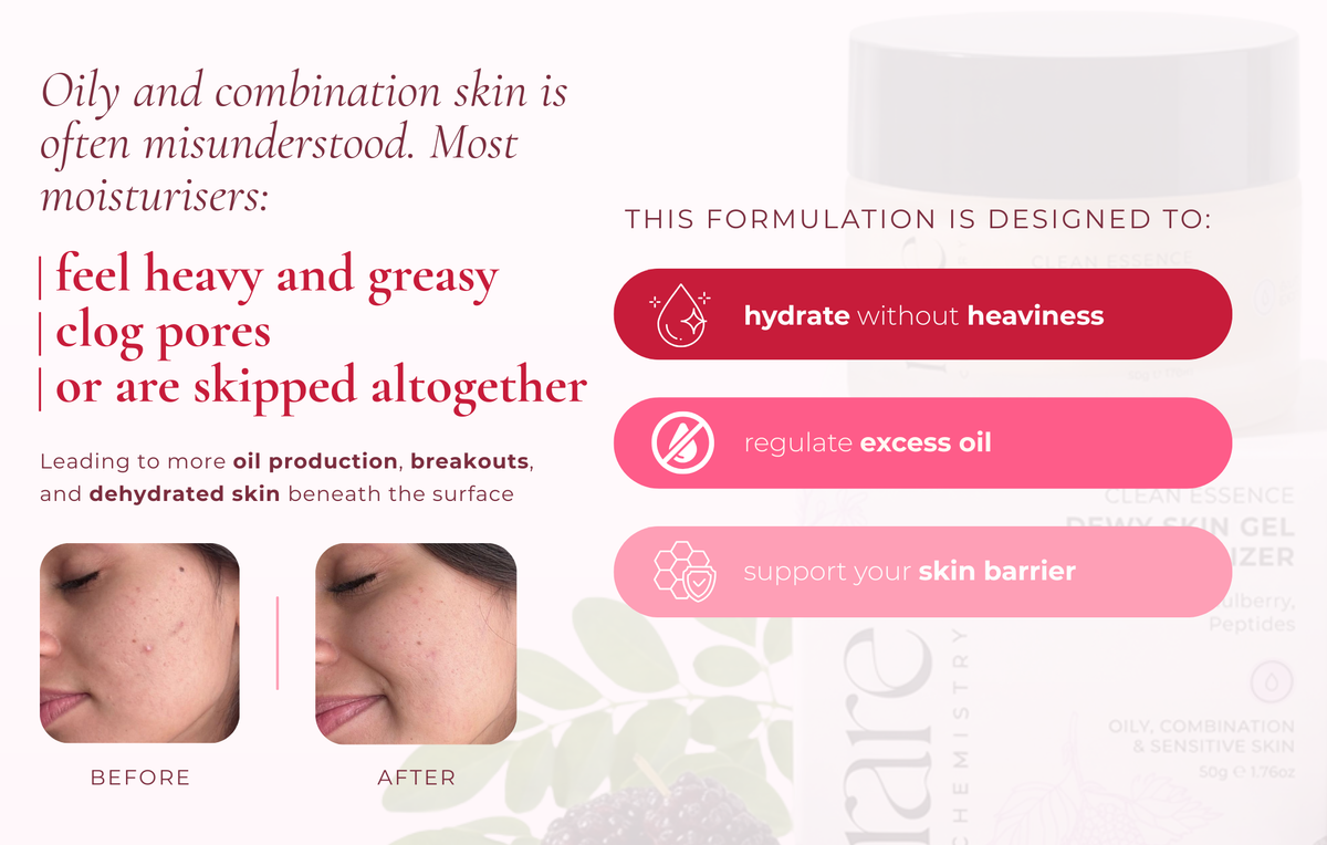 Dewy Skin Gel Moisturizer