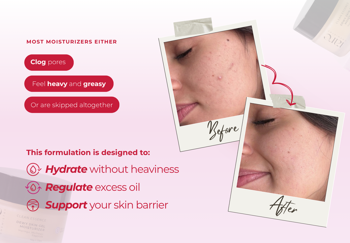 Dewy Skin Gel Moisturizer