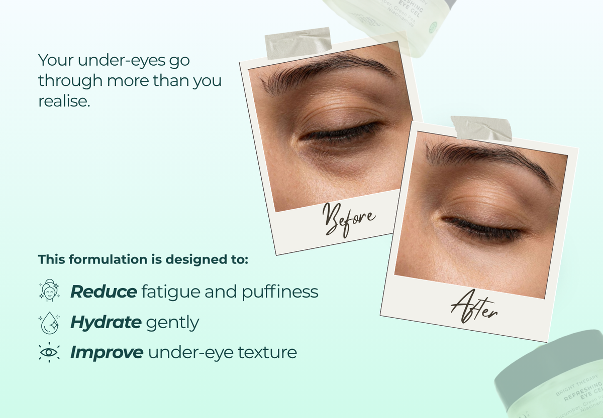 Refreshing Eye Gel
