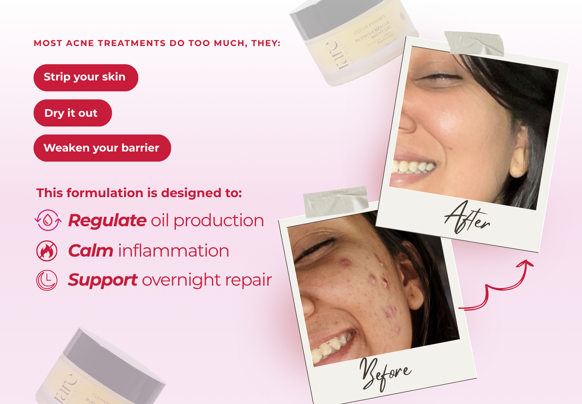 Blemish Rescue Night Gel