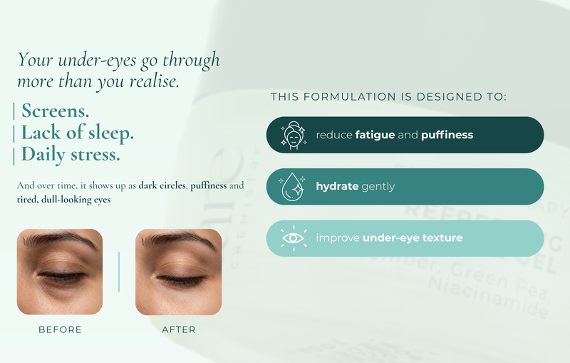 Refreshing Eye Gel