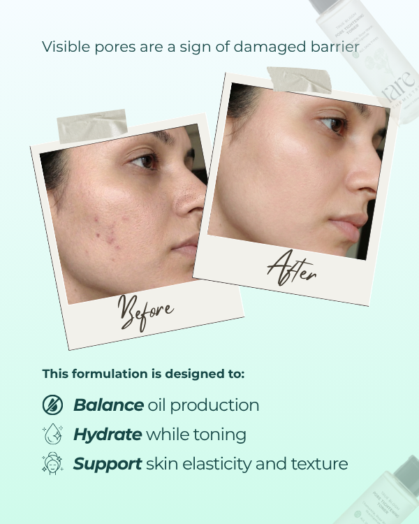Pore Tightening Toner