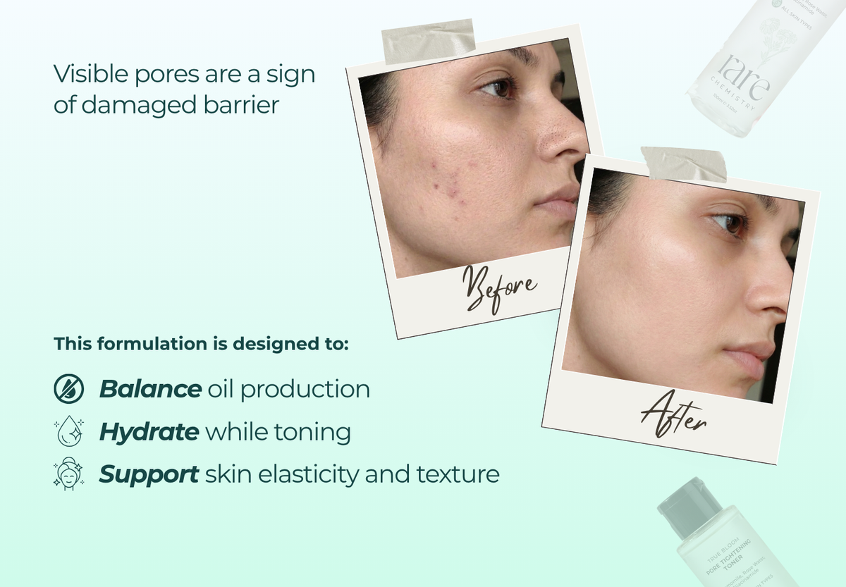 Pore Tightening Toner