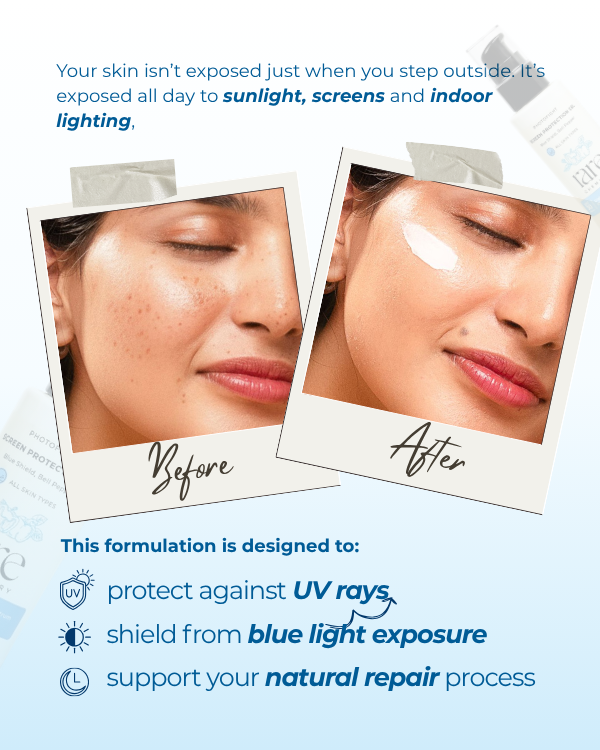 Screen Protection Gel