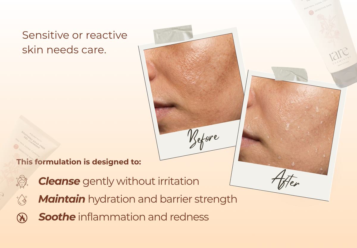 Soothing Soap Free Gel Cleanser