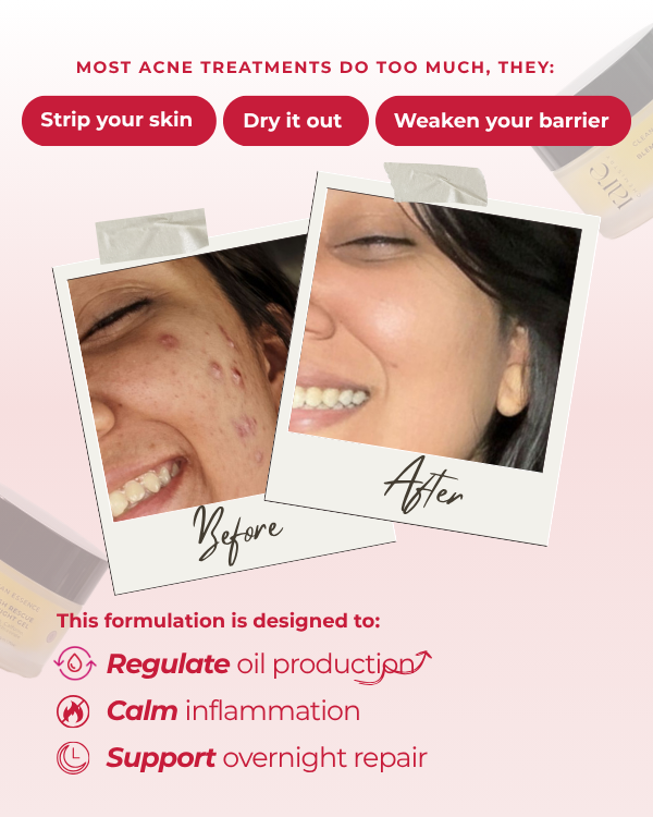 Blemish Rescue Night Gel