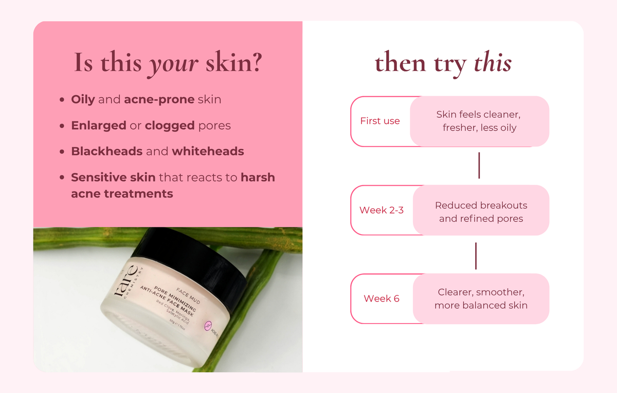 Pore Minimizing Anti Acne Face Mask