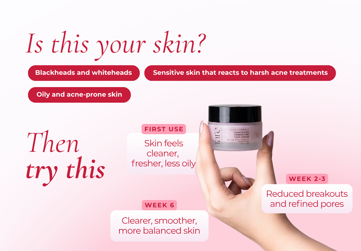 Pore Minimizing Anti Acne Face Mask