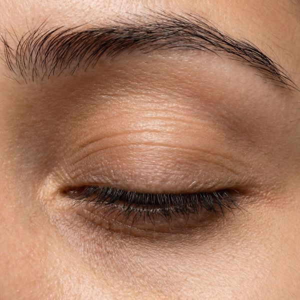 Dark Circles Puffiness