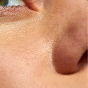 A mix of oily and dry areas