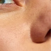 A mix of oily and dry areas